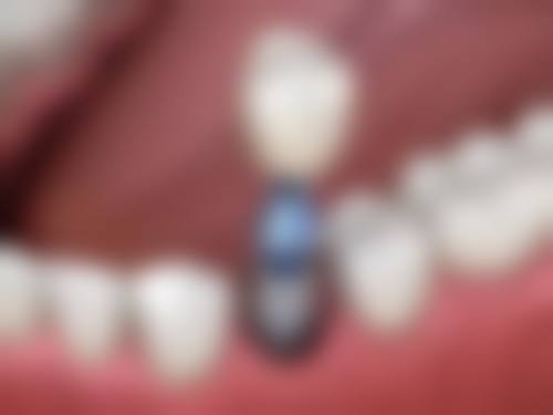 深圳美奥口腔医院的口碑评价