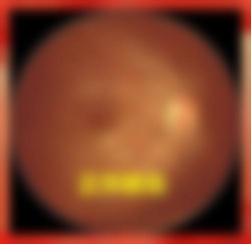吴伯乐医生擅长项目