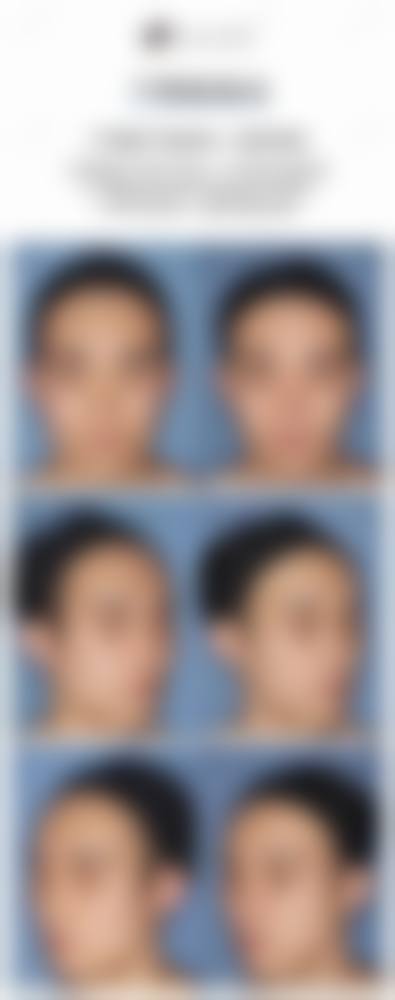 南京爱薇医疗美容门诊部擅长项目