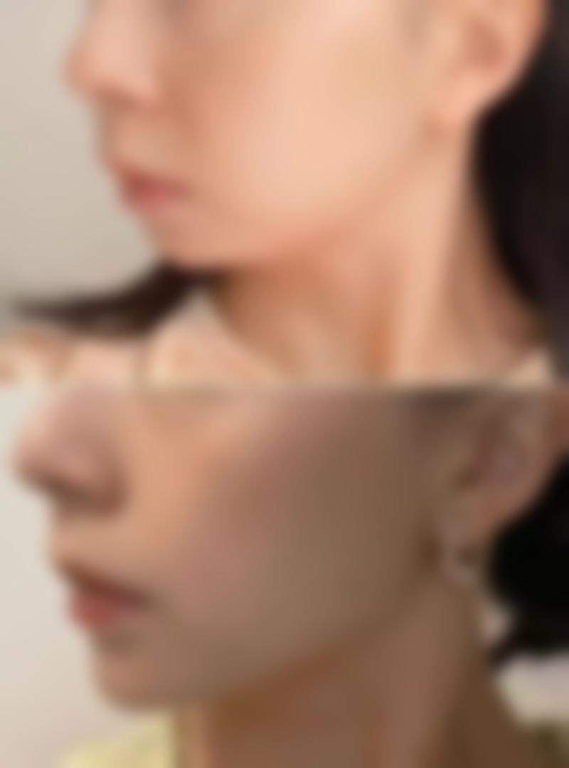 南京爱薇医疗美容门诊部口碑评价