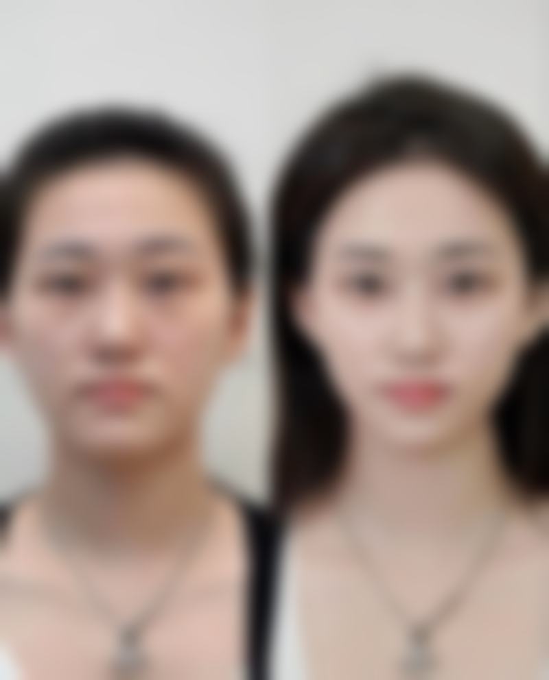 左春平擅长项目解析