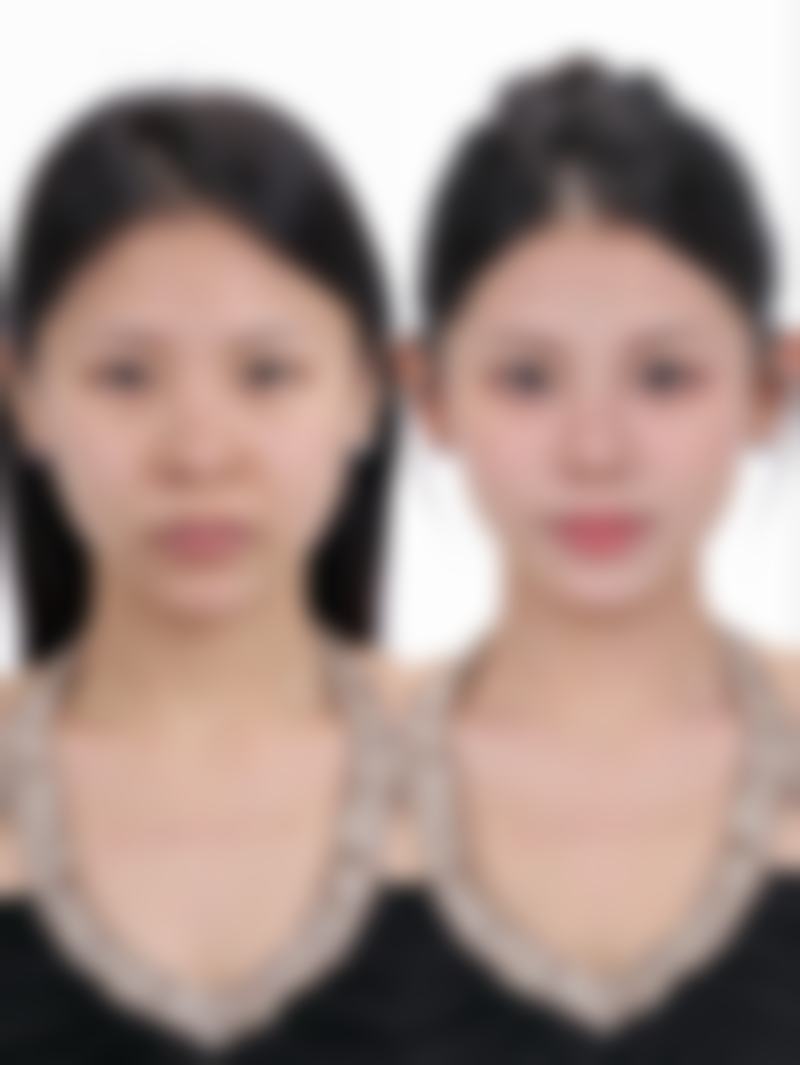 卫永军 医生技术实力展现