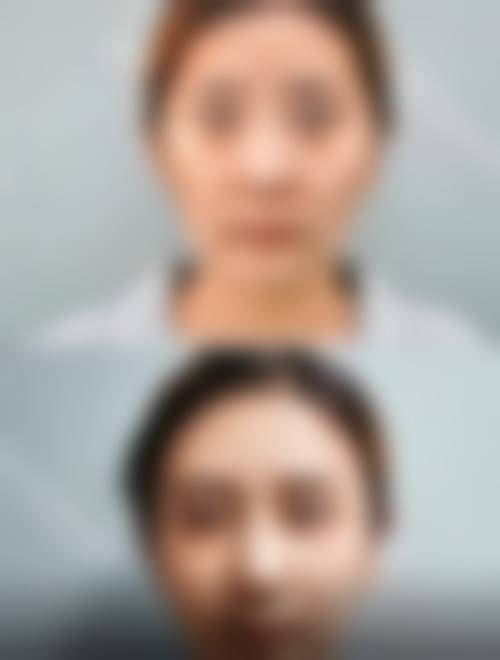 石家庄凤凰医院私密整形科预约挂号方式。