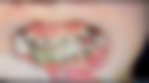温州瑞安杨晓庆口腔医生团队经验稳定。