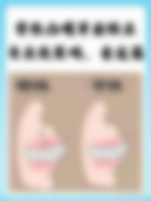 温州瑞安杨晓庆口腔擅长项目。
