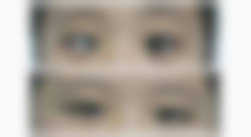 陇南市第一人民医院眼科预约挂号方式。
