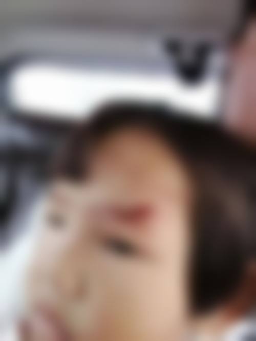 成都锦江铭依眼科门诊部门诊营业时间。