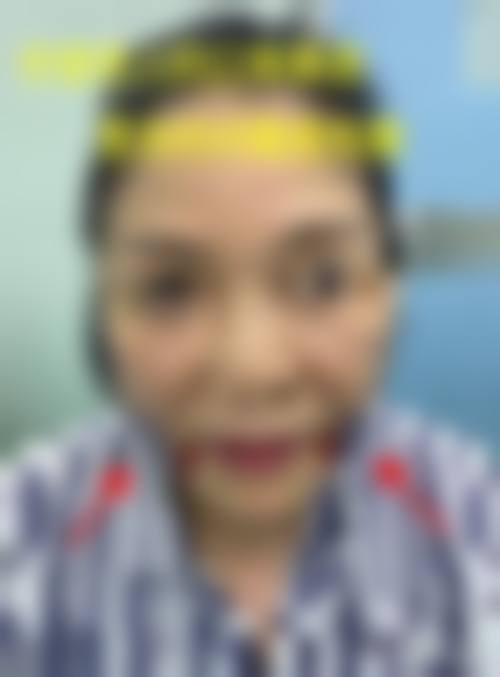 长春瑞希整形医院预约挂号方式