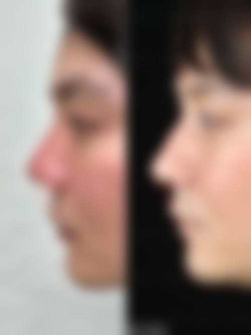 石家庄凤凰医院私密整形科地理位置便于到院。