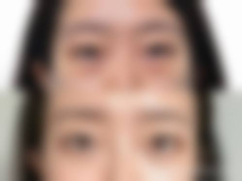 上海爱尔眼科医院整形科治疗反馈与口碑评价。