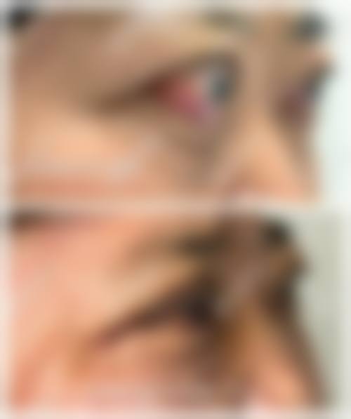 陇南市第一人民医院眼科医生团队经验稳定。