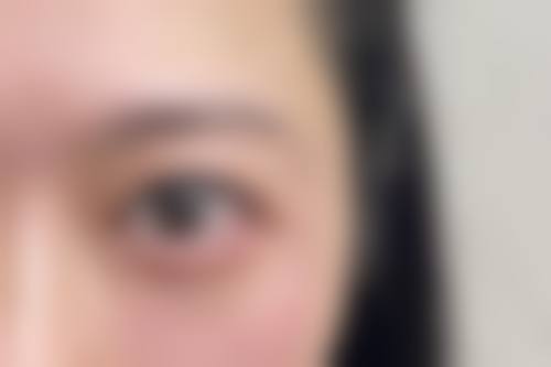 杭州珍美颜医疗美容诊所擅长项目。