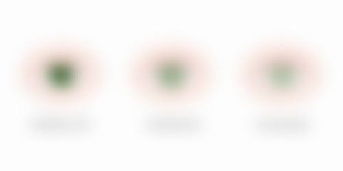 海南康伟眼科近视治疗中 心预约方式