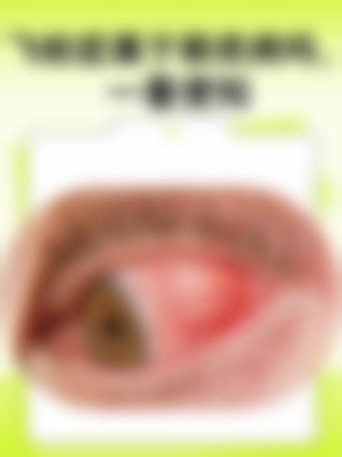 兴义市人民医院眼科擅长项目。