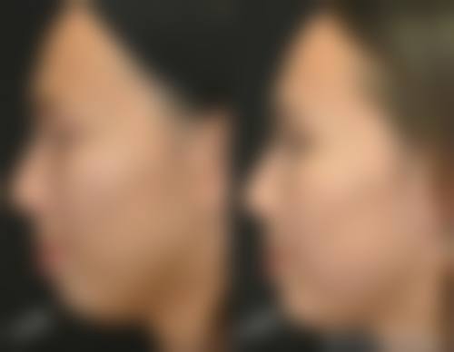 深圳名媛汇美度整形医院地理位置便于到院。