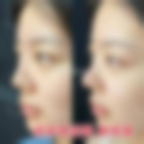 北京亚汇利中医美容有限职责公司亚韩医疗美容诊所治疗反馈与口碑评价。