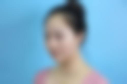 石家庄蓝山医疗美容医院植发中 心地理位置便于到院。
