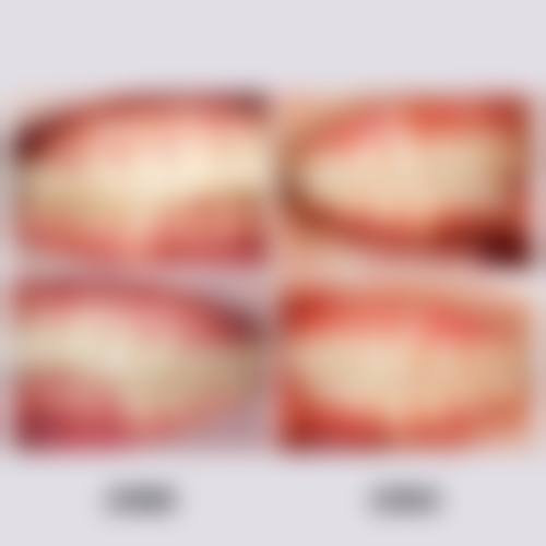 镇江句容牙一生口腔门诊部预约挂号方式