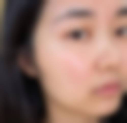 徐州澜语星灿璞颜医疗美容诊所治疗反馈与口碑评价。
