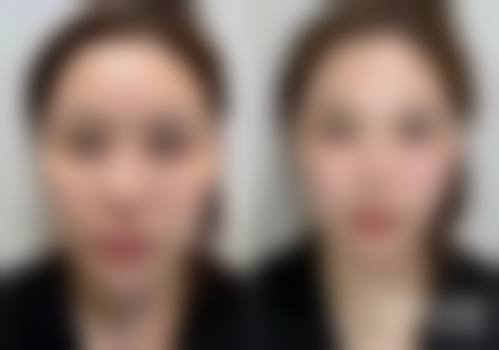 徐州澜语星灿璞颜医疗美容诊所医生团队经验稳定。