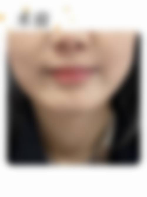 石家庄蓝山医疗美容医院植发中 心擅长项目。