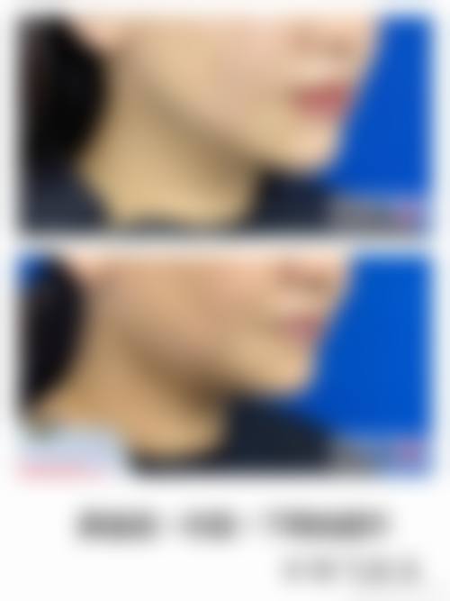 石家庄蓝山医疗美容医院植发中 心预约挂号方式。