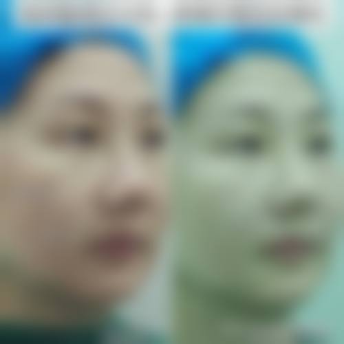 徐州澜语星灿璞颜医疗美容诊所擅长项目。