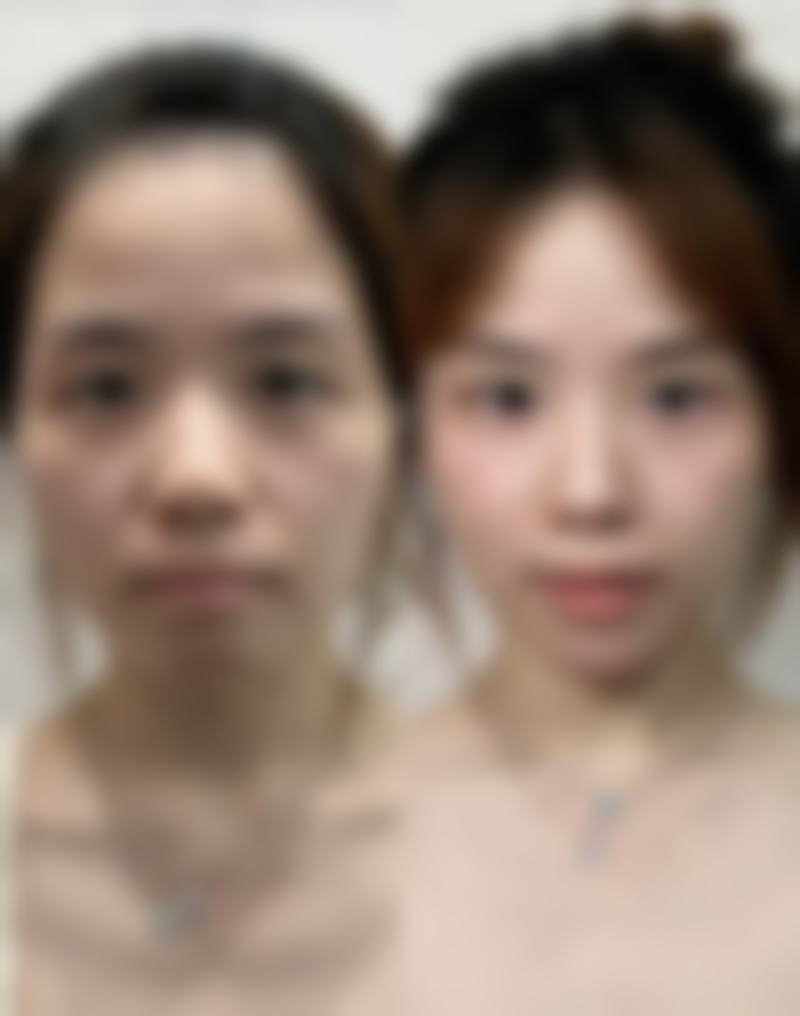 广州恬媄医疗美容诊所口碑评价