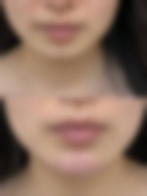 呼和浩特吴老贵医疗美容诊所擅长项目。