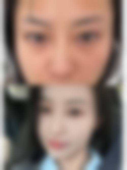 呼和浩特吴老贵医疗美容诊所治疗反馈与口碑评价。