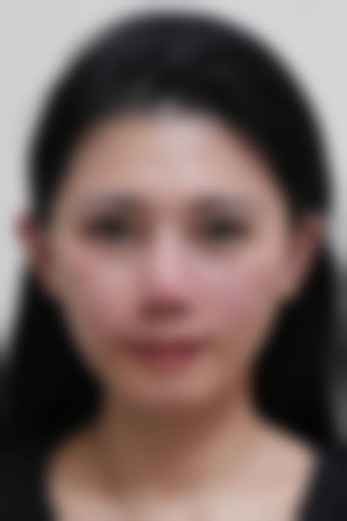 郑州美美医疗美容医院擅长项目。