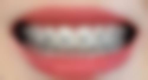 清远广研口腔治疗反馈与口碑评价