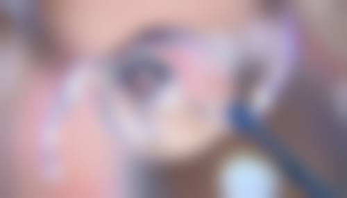 达州爱瑞眼科医院擅长项目。