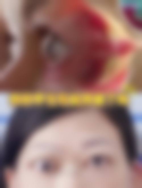 重庆阿玛施眼科门诊部2026年价格收费表：