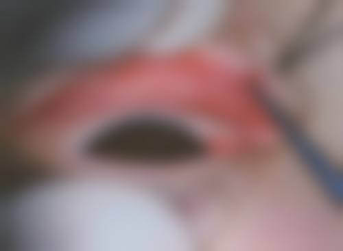 达州爱瑞眼科医院门诊营业时间。