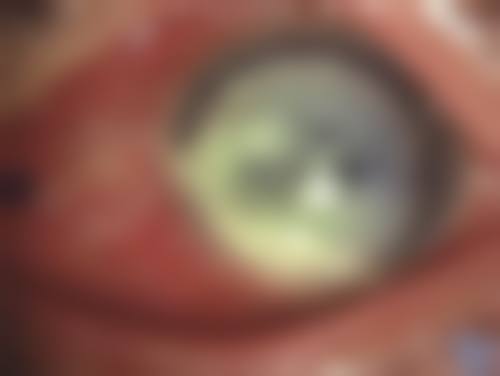 桂林医学校眼科擅长项目。