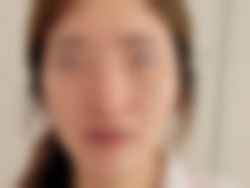 成都莱雅医疗美容治疗反馈与口碑评价。