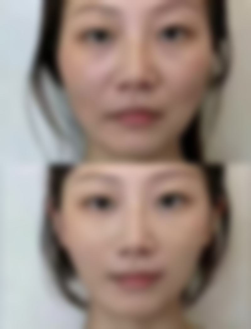 大理伊美东方丽人医疗美容诊所擅长项目。