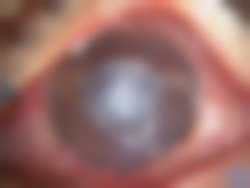 常州市第三人民医院眼科治疗反馈与口碑评价。