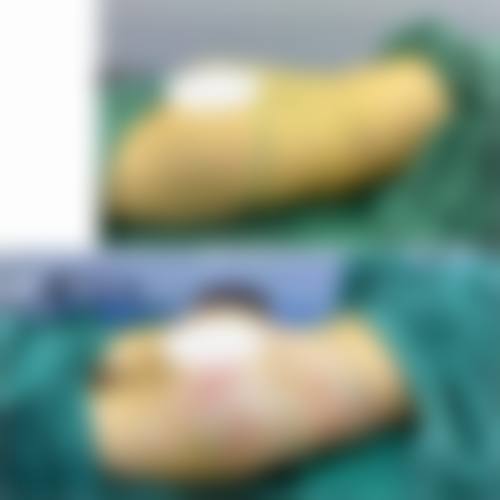 齐齐哈尔胡淑霞医疗美容诊所项目优势。