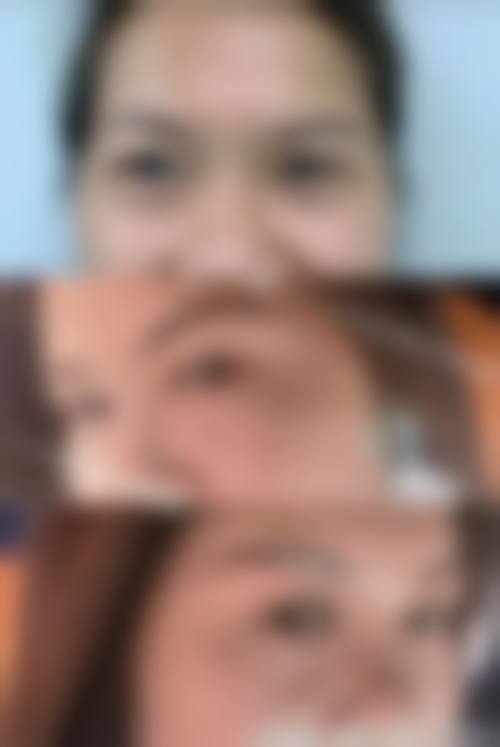 诺美医疗美容门诊部治疗反馈与口碑评价。
