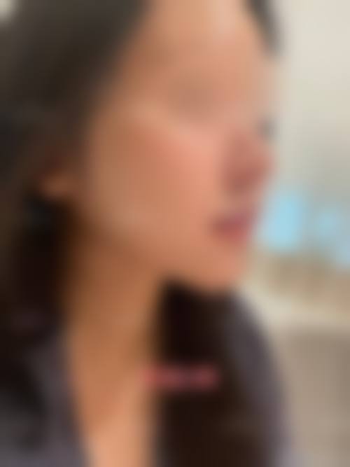 齐齐哈尔胡淑霞医疗美容诊所治疗反馈与口碑评价。
