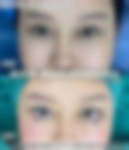 欧神治疗反馈与口碑评价。