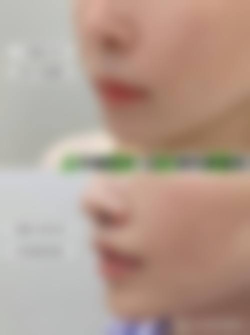 潍坊易美医学美容门诊部擅长项目。