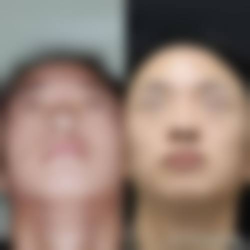 潍坊易美医学美容门诊部项目优势。