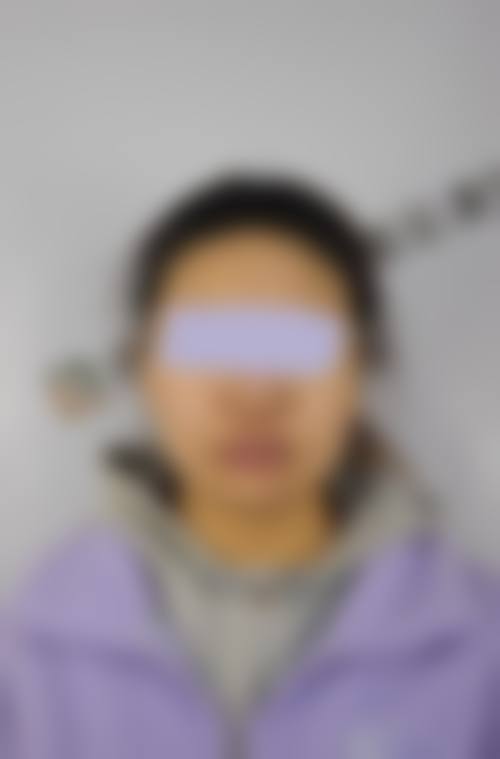 周金医生技术实力