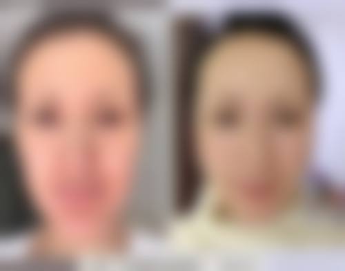 潍坊易美医学美容门诊部2026年价格收费表：
