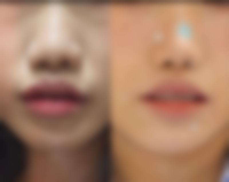 天津薇斯医疗美容诊所设备与项目