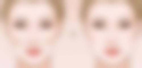 郭增医生技术或实力