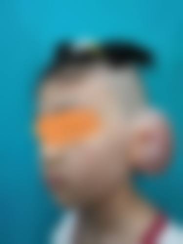 天津滨海新区娅芪媛医疗美容门诊部擅长项目。